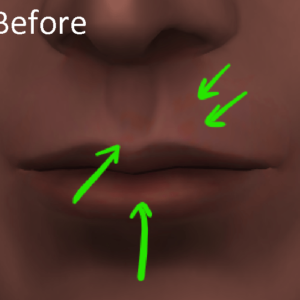 The Sims 4 Red Spots near Mouth Before Updates