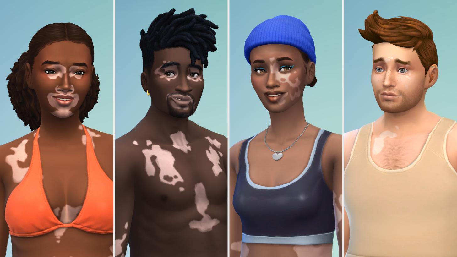 The Sims 4 Vitiligo Update