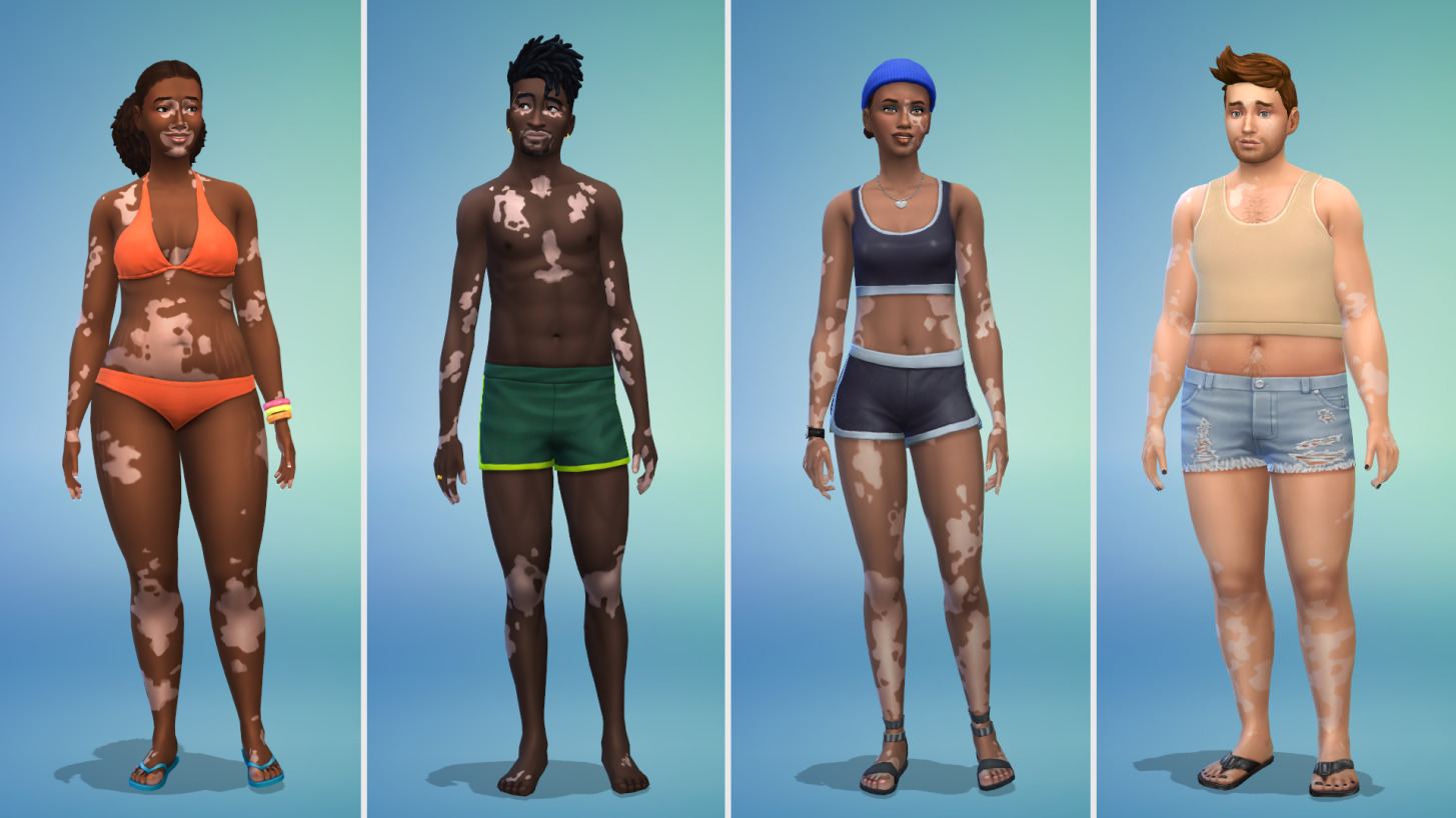 The Sims 4 Vitiligo Update