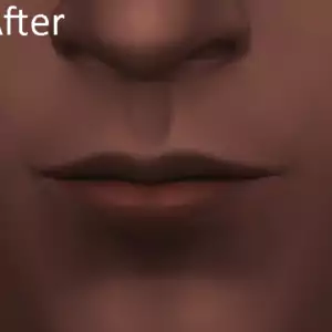 The Sims 4 Red Spots near Mouth After Updates